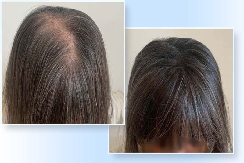 Hélène Pinsonneault massothérapeute